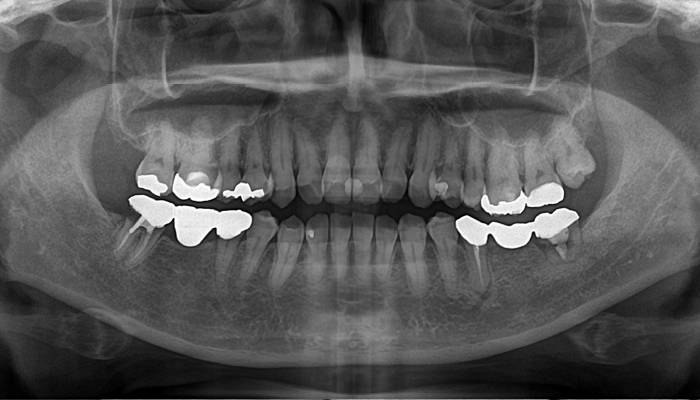 口腔外科の症例